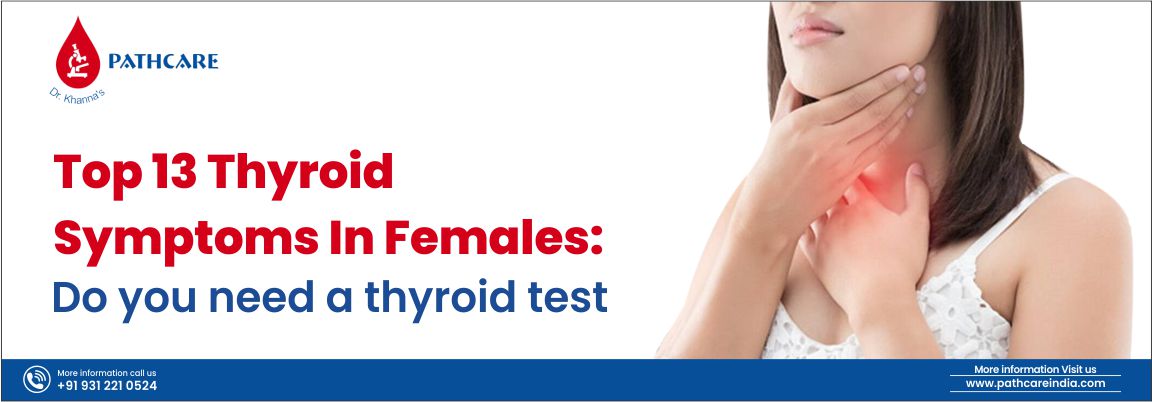 Thyroid-profile-test